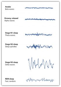 This chart shows electroencephalogram (EEG) recordings of brain patterns during the different stages of consiouscness, including when awake, drowsy/relaxed, stage N1 sleep, stage N2 sleep, stage N3 sleep, and REM sleep.